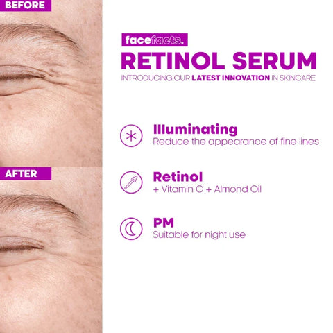Face Facts Renew + Radiance Retinol Serum 30ml